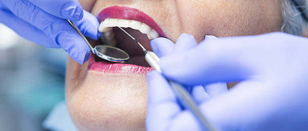 Best Emergency Tooth Extraction in Rush City, MN